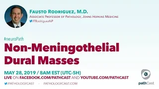 Non-meningothelial dural masses - Dr. Rodriguez (Hopkins) #NEUROPATH