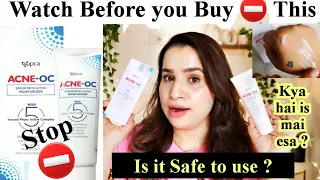 Acne OC moisturiser Review | Best Moisturizer for Acne Prone Skin ?