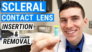 How to Insert and Remove SCLERAL LENSES | Beginners Guide to Scleral Lenses