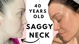 How to tighten and tone saggy neck skin- 40 years old