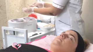 Lip waxing procedure