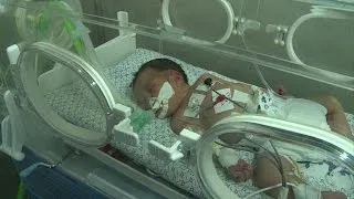 Gaza doctors save baby from her dead mother's womb