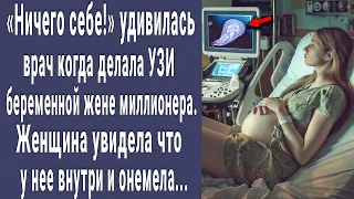 Ничего себе! удивилась врач на УЗИ беременной пациентке. Женщина увидела снимок и побледнела...