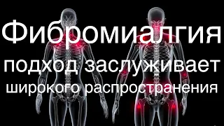 Фибромиалгия:  подход заслуживает широкого распространения