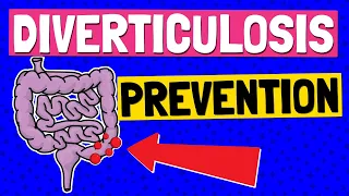 Diverticulosis TREATMENT & PREVENTION 🍴 Which FOODS to EAT and AVOID!