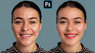 Face Retouching - Best Photoshop Tutorial | Skin Retouching