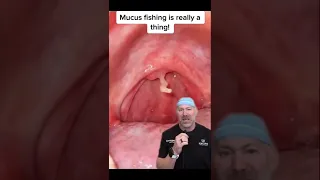 Mucus Fishing is the Craziest Trend Yet 😱 #shorts