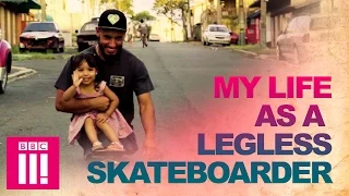 The Extraordinary Double Amputee Skateboarder | Living Differently