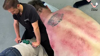 Chiropractor PUTS Full Weight 😳 Into Man's Back To Loosen *Tight Joints* - Gua Sha & A CRUNCHY NECK