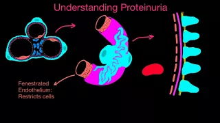 Proteinuria #1