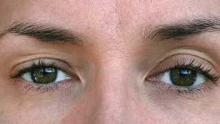 how to get rid of uneven eyelids fast