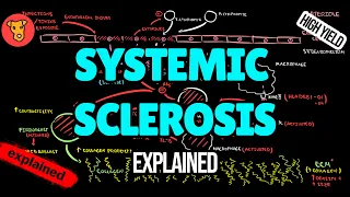 SCLERODERMA (Systemic sclerosis) Pathogenesis Diagnostic criteria Classification EULAR Treatment