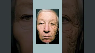 This Is What 28 Years Of Sun Damage Looks Like