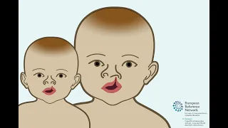 Embryonic development: Cleft lip and/or palate