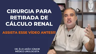 Tudo sobre cirurgia de remoção de cálculos volumosos | Nefrolitotripsia Percutânea