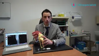 La Protesi Monocompartimentale di Ginocchio | Dr. Alessio Biazzo
