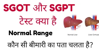 SGOT Blood Test  | SGPT Blood Test | ALT | AST | SGOT & SGPT Test Normal Range@MLTLabManual2.0