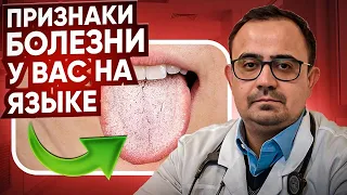 Ваш ЯЗЫК РАССКАЖЕТ многое о вашем здоровье!