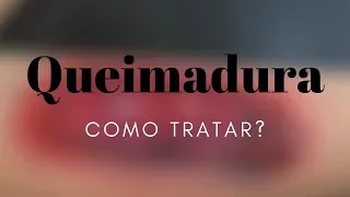 Como tratar QUEIMADURAS - o que fazer para tratar