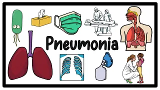 Pneumonia Explained: Causes, Symptoms & Treatment of Lung Infection