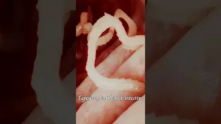 Tapeworm in Human Intestine | Taenia sp | Flat worms | Endoparasites | Phylum Platyhelminthes