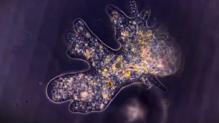 5 minutes of Amoebae, the shapeshifters of the microverse