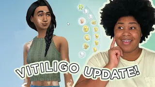 Free Vitiligo Update in The Sims 4 | Free Base Game SDX Update