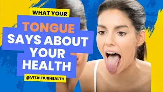 Tongue & Health Secrets: What Your Tongue Reveals About Your Health- 5 Common Symptoms To Notice