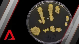 The bacteria living on your hands right now