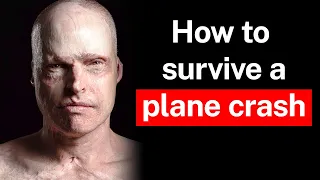 The Incredible Story of Jamie Who Survived a Plane Crash