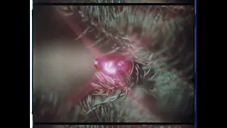 CPSC PSA Archive | Christmas Tree Safety