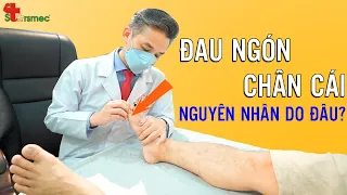 Đau khớp ngón chân cái - Nguyên nhân do đâu? | Bác sĩ Thể thao Nguyễn Trọng Thuỷ