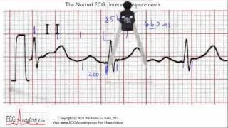 Interval Practice 6-5 - ECG / EKG Interpretation -- BASIC