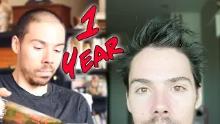 1 Year Male Pattern Baldness Reversal: How I Did It