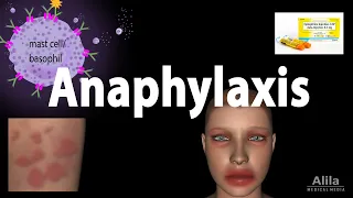 Anaphylaxis, Animation