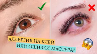 КРАСНЫЕ ГЛАЗА ПОСЛЕ НАРАЩИВАНИЯ РЕСНИЦ!  ВСЕ ПРИЧИНЫ И КАК ИЗБЕЖАТЬ?