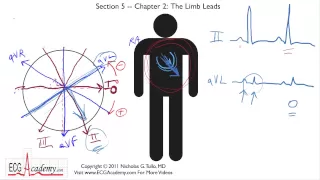 Frontal or Limb Leads 5-2 - ECG / EKG Interpretation -- BASIC