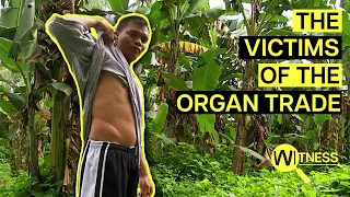 Organ Thieves: Inside the Dark World of Organ Trafficking | Organ Trade Documentary