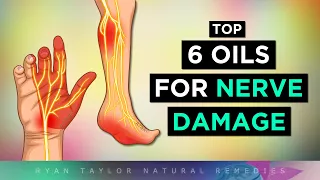 6 Best Oils For NERVE Damage