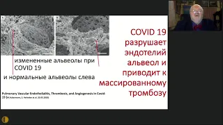 Инфекция COVID-19 - год сосуществования | профессор, Воробьев Павел Андреевич, (Боткинские чтения)