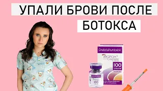 УПАЛИ БРОВИ ПОСЛЕ БОТОКСА.