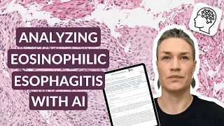 Eosinophilic esophagitis | Quantitative analysis of histopathology with AI