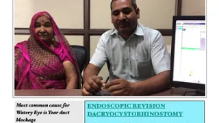 Watering from Eyes | Tear duct block | Endoscopic DCR | Dacryocystorhinostomy | Revision Surgery