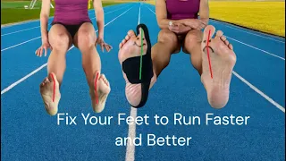 Runners Fix Your  Feet to Run Faster and Better with No Foot Pain! #runningform #Bunions #Foot Pain🏃
