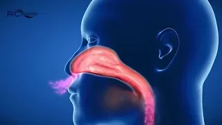 Atemtherapiegerät RC-Cornet® PLUS NASAL - Wirkprinzip 3D-Animation - freie Nase ohne Medikamente