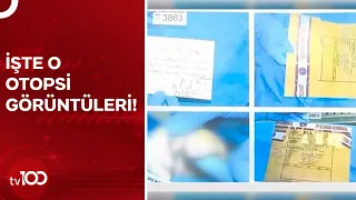 Cem Garipoğlu'nun Otopsi Görüntüleri Ortaya Çıktı | TV100 Haber