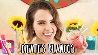 ¡DIENTES SUPER BLANCOS/ MI SECRETO!   -Yuya