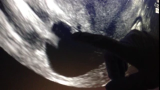6 Week Ultrasound with Heartbeat!