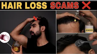 Worst Hair Loss SCAMS❌ *NATURALLY Regrow* Teenage Hair Loss | Hair fall| Hair thinning| Indian Hair