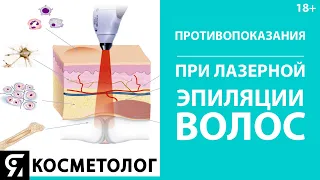 Противопоказания при лазерной эпиляции волос